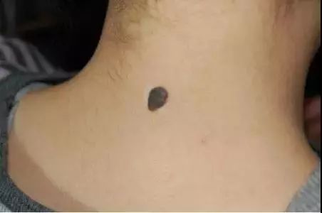 ݱƤר