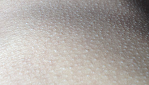 ݱƤר